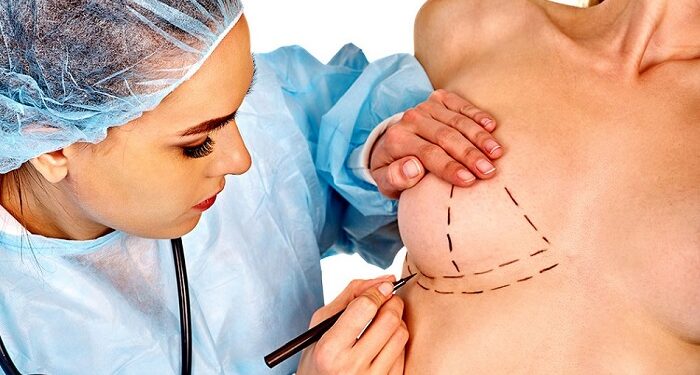 Маммопластика Киев: путь к идеальной груди с профессиональным пластическим хирургом